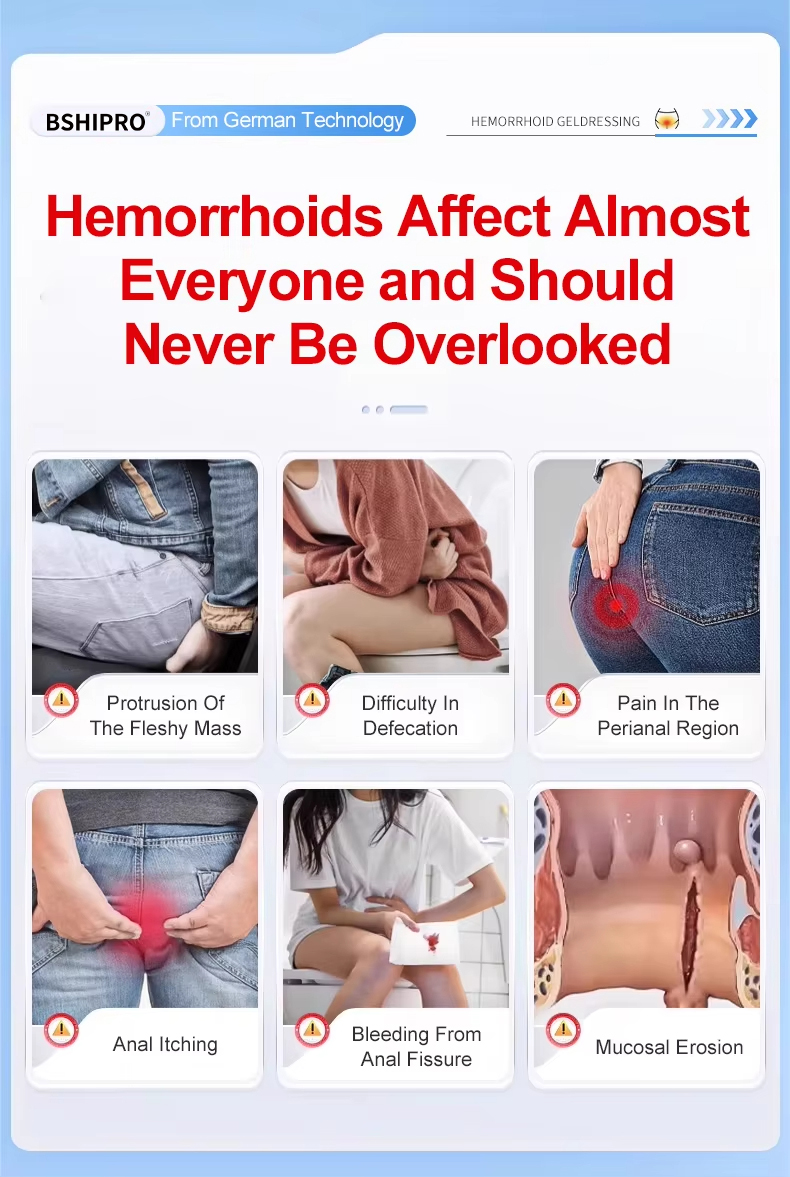 Natural Herbal Hemorrhoid Cream Steroid-Free Gentle Formula for Sensitive Skin Pregnancy-Safe 