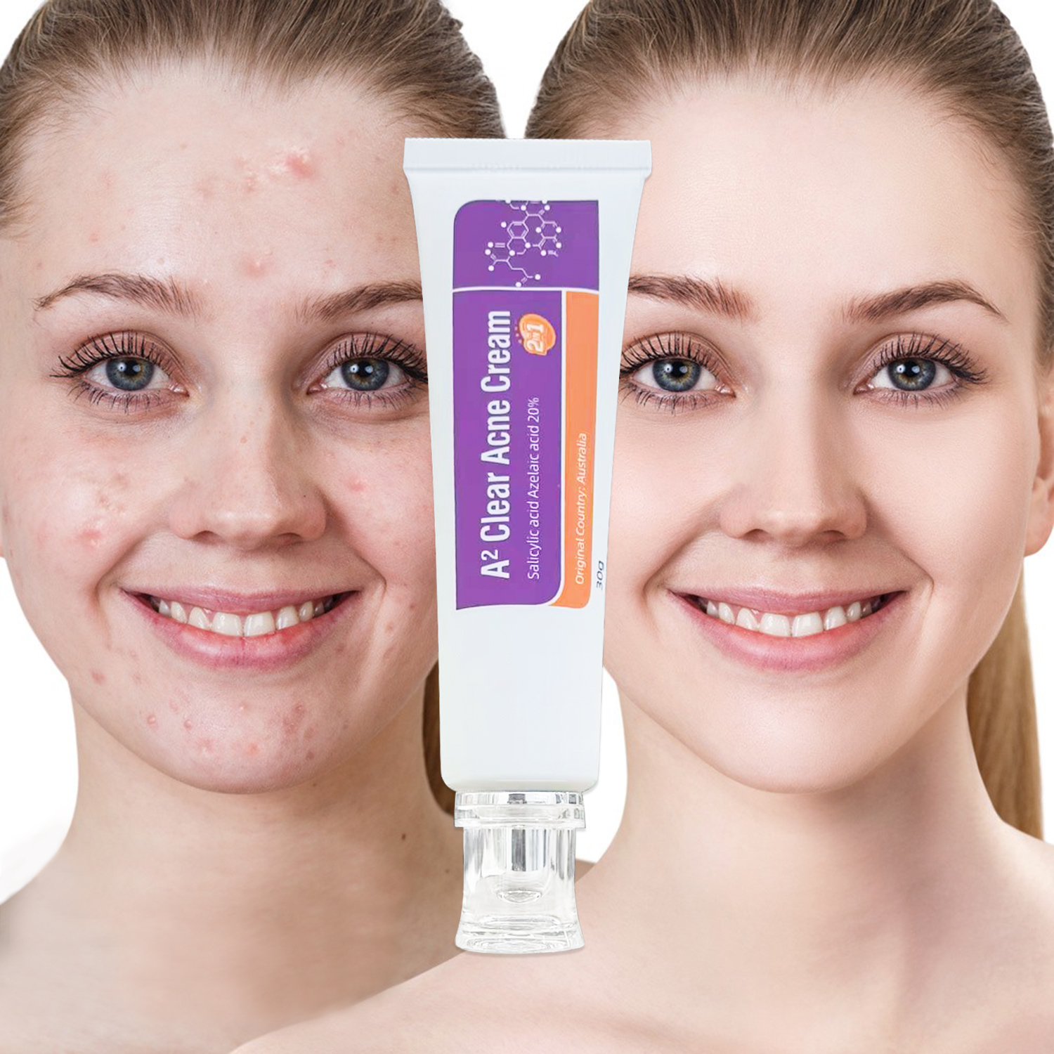 Hydrating & Soothing Facial Cleanser Acne Removal Cream for All Skin Types