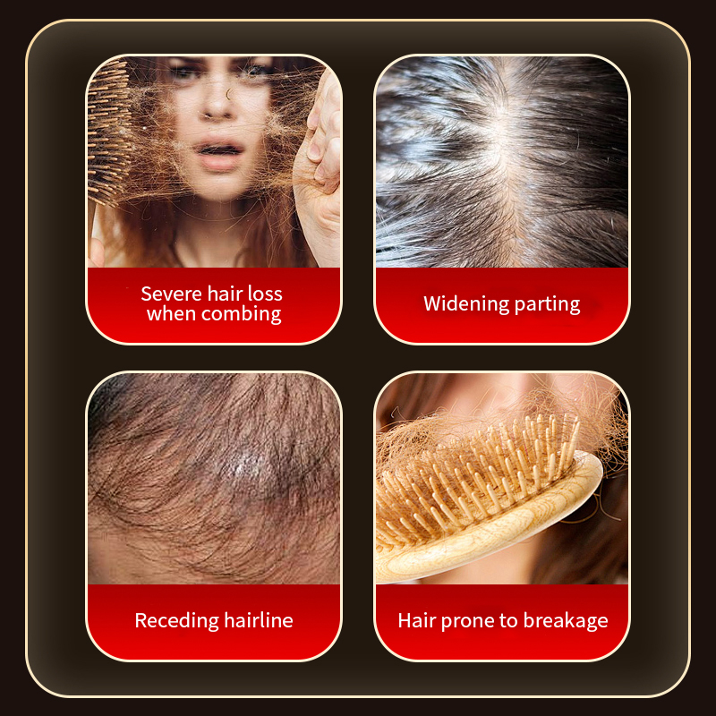 Oil-Control & Anti-Dandruff Strengthens Roots, Nourishes Hair & Prevents Hair Loss Refreshing Anti-Hair Loss Formula Shampoo