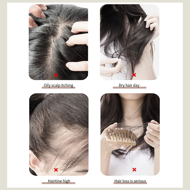 SFDA Certified 5 Planting Extracts Anti-Hair Loss Fixed Shampoo 500ML for Hair Root Strengthening &Thinning Hair & Hair Fixing