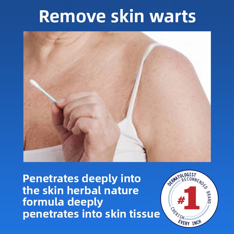 Herbal Plant Essence Extract for Wart Removal Effective Solution for Foot Flesh Balls Crossed Warts