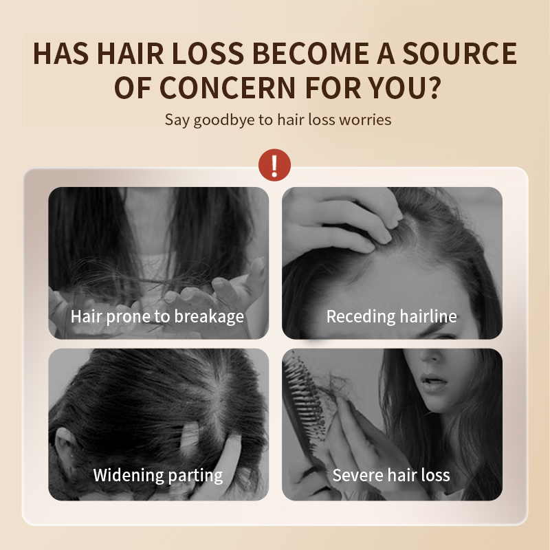 Teyi Customised 300ml Ginger Hair Growth Shampoo Strengthening Roots Dandruff Control and Oil Regulation Hair Loss Prevention