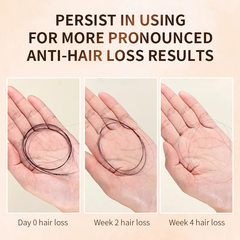 Strengthen Roots Thicken Hair Control Oil Add Volume Refresh Scalp Ginseng Anti-Hair Loss Shampoo 400ML Cream Formula