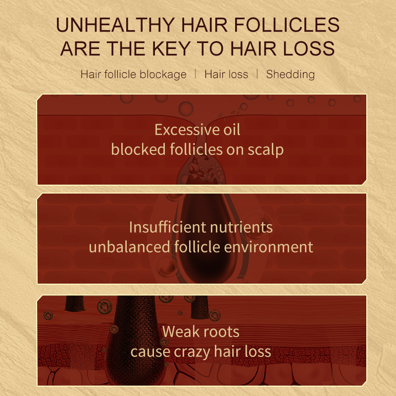 Purifying Regulates Oil Reinforces Roots Anti-Hair Loss Elixir Anti-Drop Shampoo 500ML for Oily & Sensitive Scalp