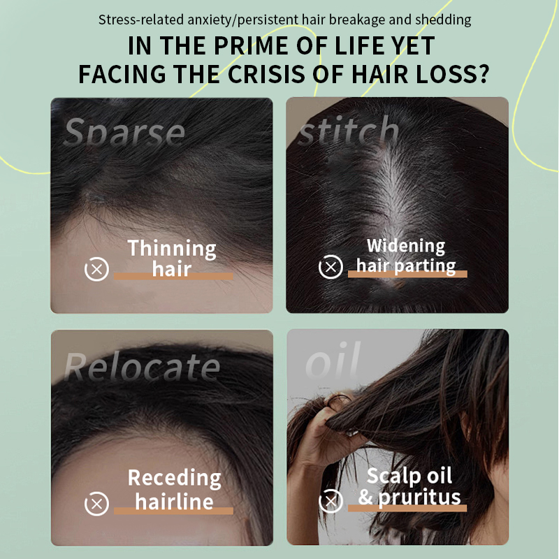 Natural Biota Orientalis Anti-Hair Loss Refreshing Shampoo 500ML for Oily Scalp & Reducing Hair Fall for Men and Women