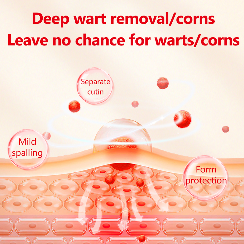 Sharp Wart Liquid Natural Ingredients Rapid Wart and Corn Removal 40% Salicylic Acid Tag Wart Remover Pads