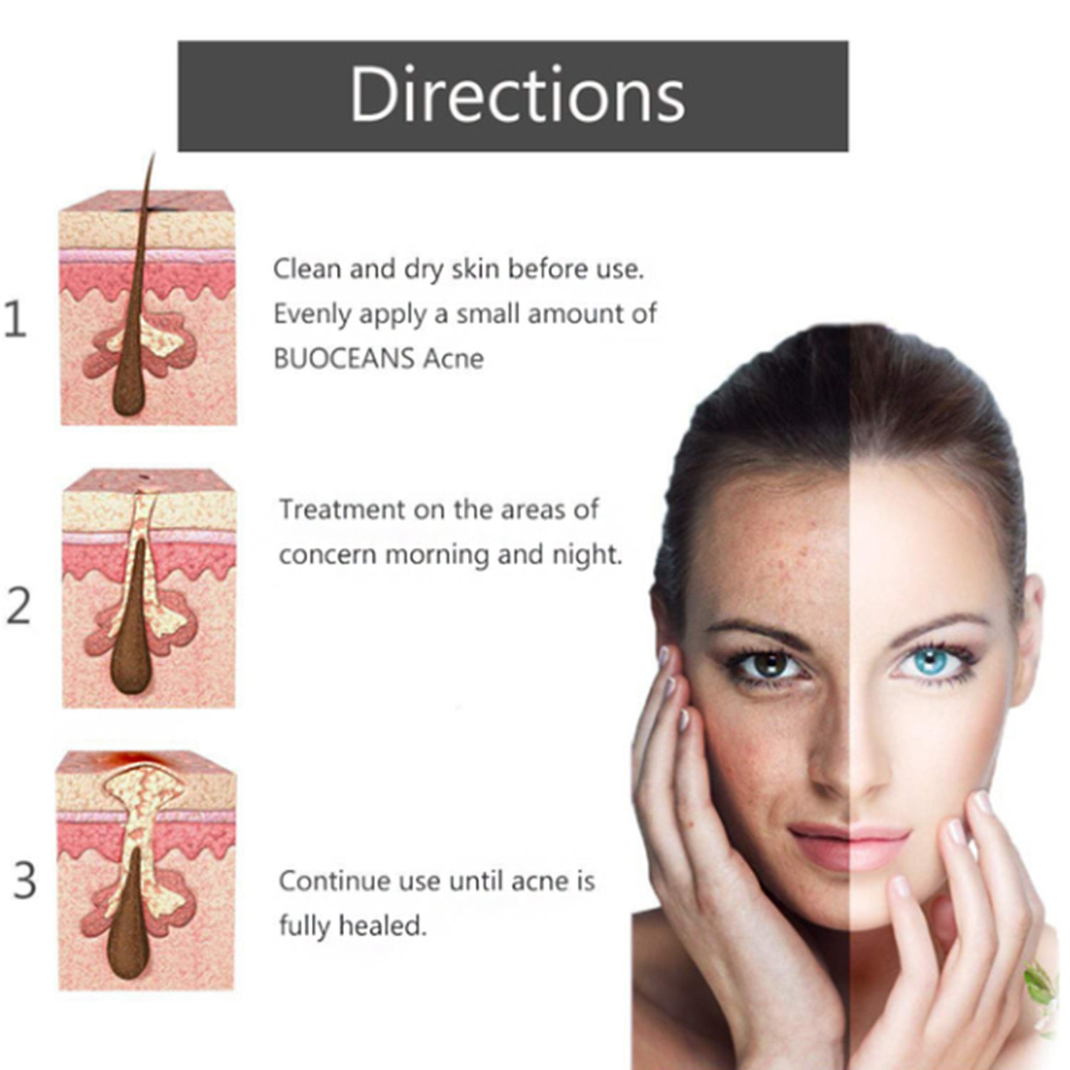 Hydrating & Soothing Facial Cleanser Acne Removal Cream for All Skin Types