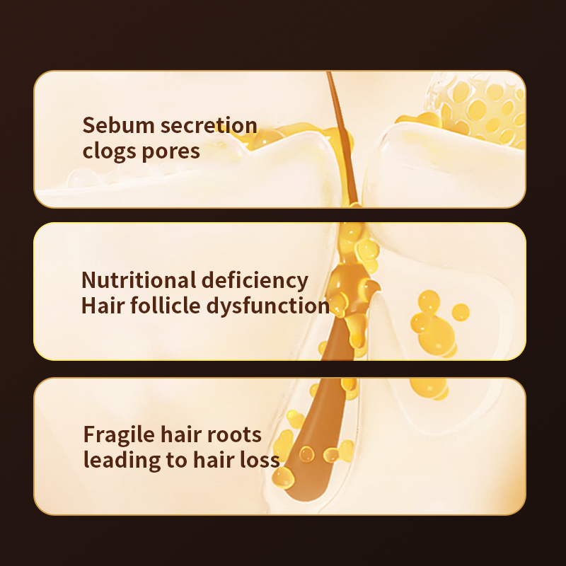 Oil-Control & Anti-Dandruff Strengthens Roots, Nourishes Hair & Prevents Hair Loss Refreshing Anti-Hair Loss Formula Shampoo