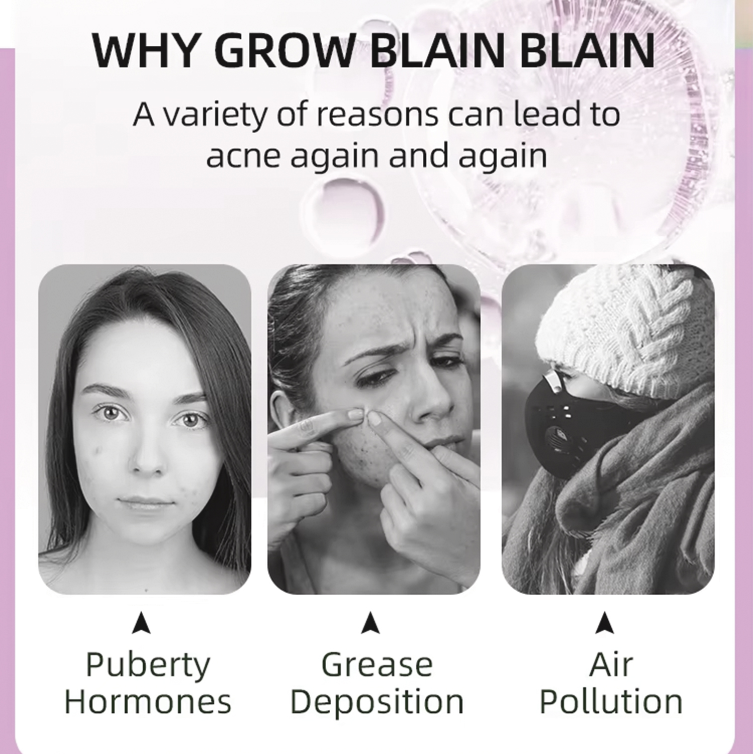 Fasting Acting Acne Removal Cream for Clearing and Preventing Blemishes & Clogged Pores