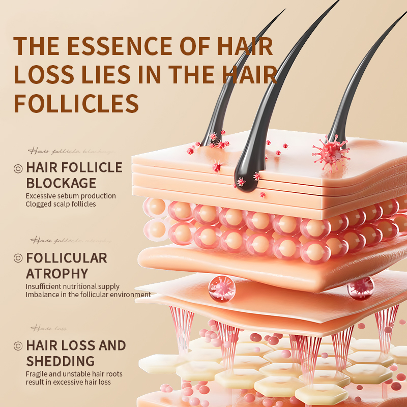 Teyi Customised 300ml Ginger Hair Growth Shampoo Strengthening Roots Dandruff Control and Oil Regulation Hair Loss Prevention