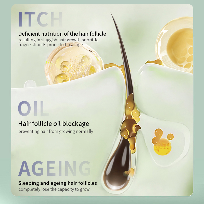 Natural Biota Orientalis Anti-Hair Loss Refreshing Shampoo 500ML for Oily Scalp & Reducing Hair Fall for Men and Women