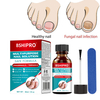 Fungal Nail Repair Liquid Foot Fungus Nail Brush Kit Nail Repair Essence Toenail Fungus Treatment